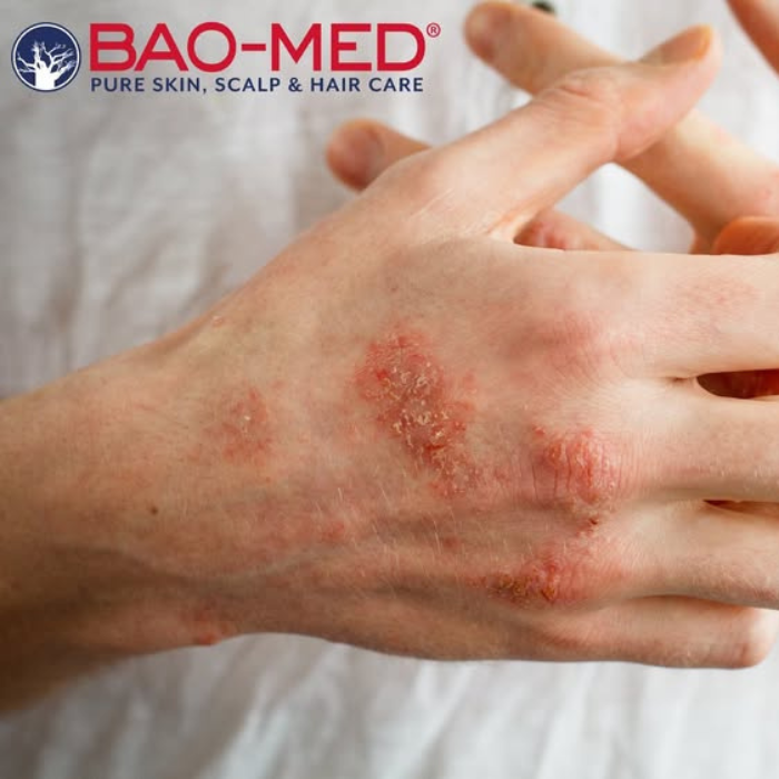 MEDICEUTICALS Bao-Med Oil ingredients graphic