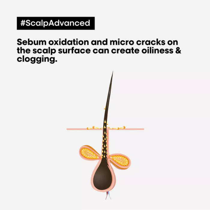 L'Oréal Scalp Advanced Anti-Oiliness Shampoo 300ml – view 9