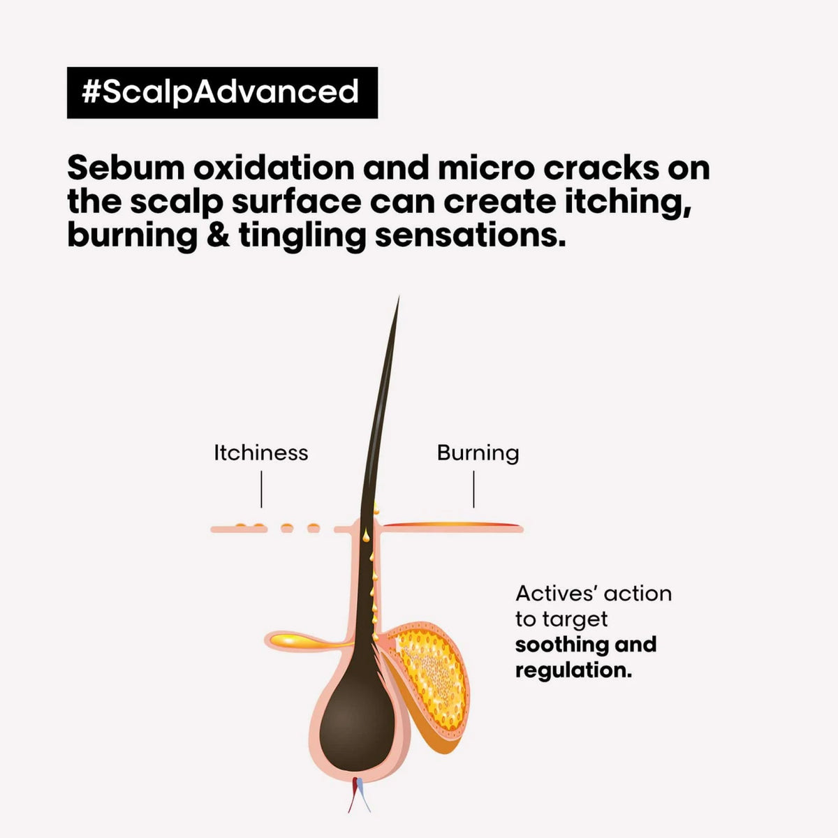L'Oréal Scalp Advanced Anti-Oiliness Shampoo 300ml – view 14