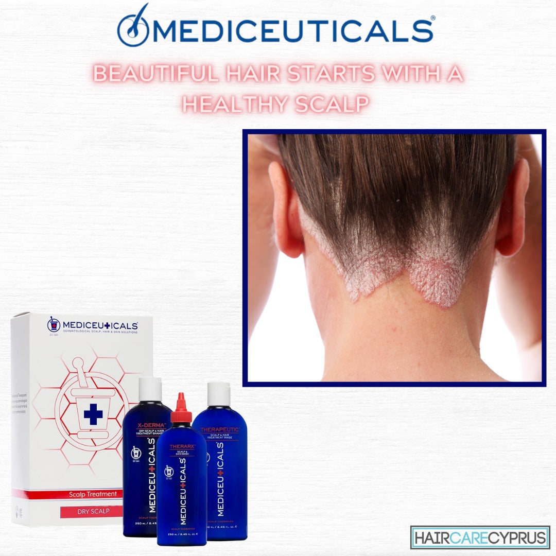MEDICEUTICALS Scalp Treatment Kit X-Folate For Dandruff and Psoriasis