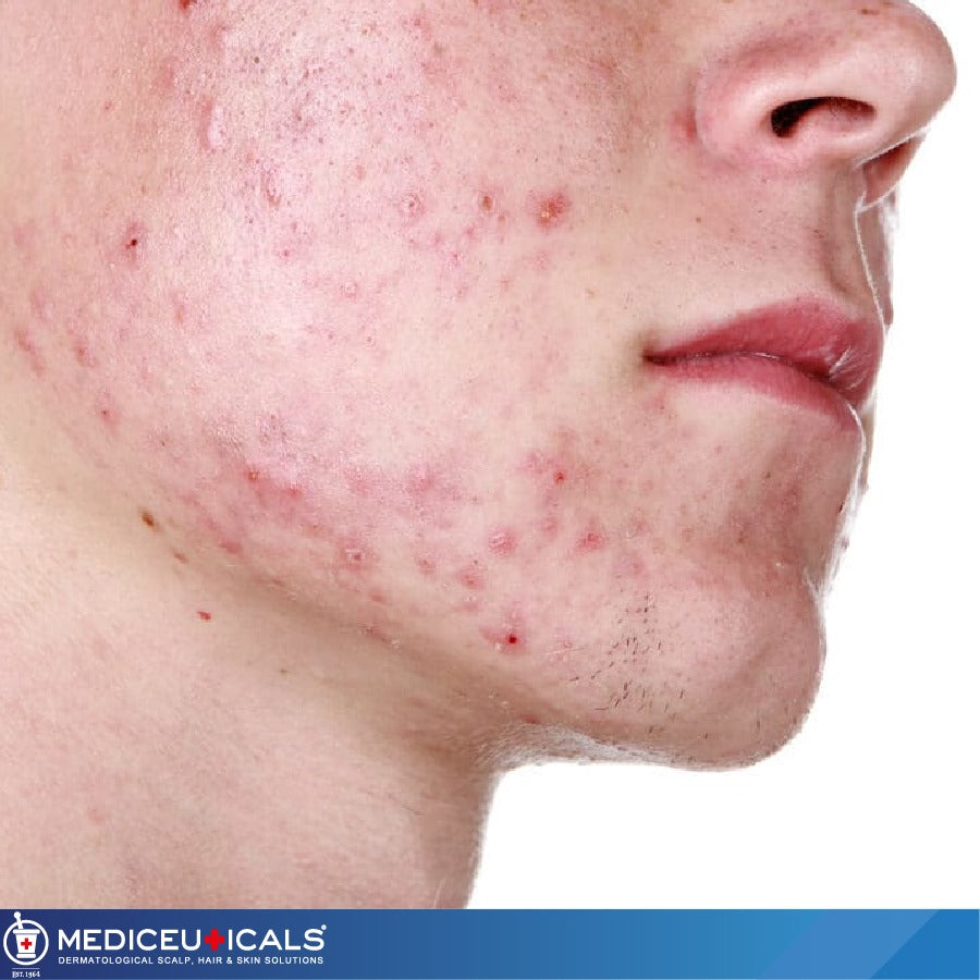 MEDICEUTICALS THERARX Tonic before and after results