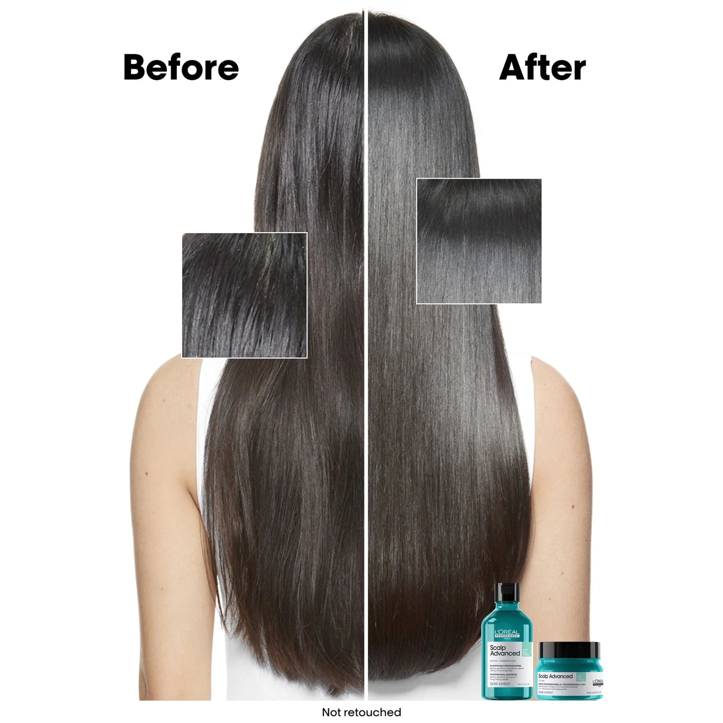 LOREAL Scalp Advanced Shampoo for Anti-oiliness 300ml