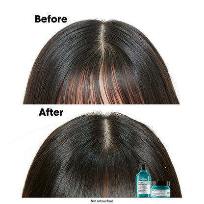 LOREAL Scalp Advanced Shampoo for Anti-oiliness 300ml