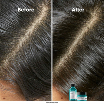LOREAL Scalp Advanced Shampoo for Anti-oiliness 300ml